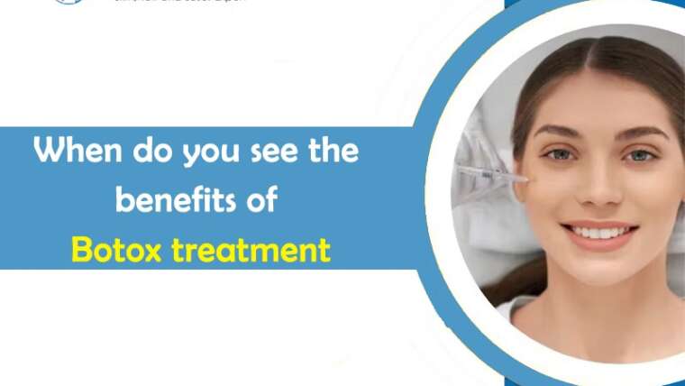 When do you see the benefits of Botox treatment?