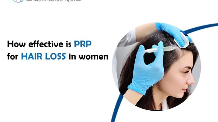 How effective is PRP for hair loss in women?