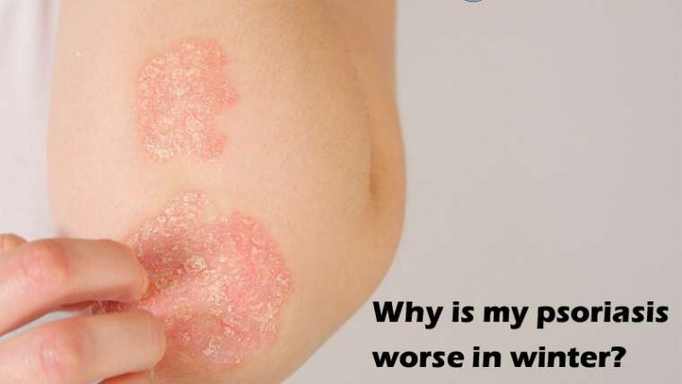 Why is my psoriasis worse in winter?