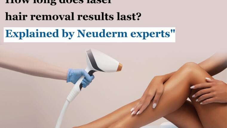 How long does laser hair removal results last? Explained by Neuderm experts