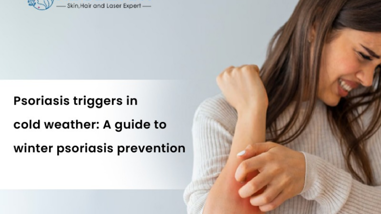 Psoriasis triggers in cold weather: A guide to winter psoriasis prevention