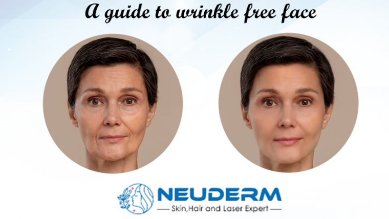 Botox wrinkle treatment: A guide to wrinkle-free face